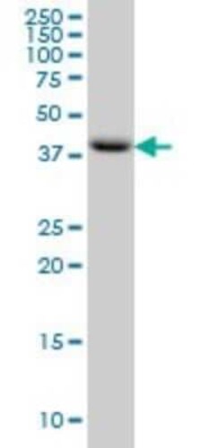 PDCD2L Antibody (5F9), Novus Biologicals 0.1 mg | Buy Online | Novus Biologicals | Fisher Scientific