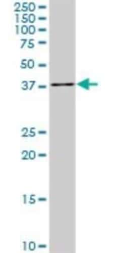 PDCD2L Antibody (5F9), Novus Biologicals 0.1 mg | Buy Online | Novus Biologicals | Fisher Scientific