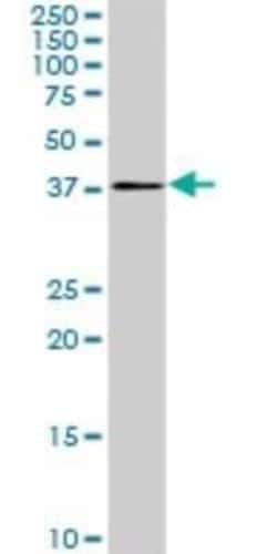 PDCD2L Antibody (5F9), Novus Biologicals 0.1 mg | Buy Online | Novus Biologicals | Fisher Scientific