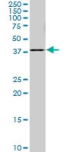 PDCD2L Antibody (5F9), Novus Biologicals 0.1 mg | Buy Online | Novus Biologicals | Fisher Scientific