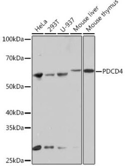 PDCD4 Rabbit anti-Human, Mouse, Rat, Clone: 3A8V10, Novus Biologicals:Antibodies:Primary