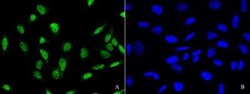 PDCD4 Antibody, Novus Biologicals:Antibodies:Primary Antibodies