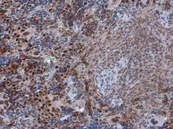 PDCD4, p Ser457 Antibody, Novus Biologicals 100 &mu;g; Unconjugated:Antibodies,