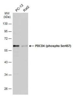 PDCD4, p Ser457 Antibody, Novus Biologicals 100 &mu;g; Unconjugated:Antibodies,
