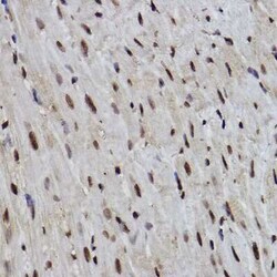 PDCD7 Rabbit anti-Human, Mouse, Rat, Clone: 8A1Q3, Novus Biologicals 100
