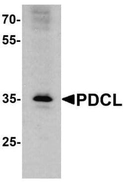 PDCL Antibody - BSA Free, Novus Biologicals 0.1 mg; Unconjugated:Antikörper