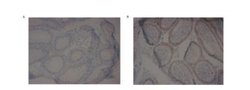 PDE10A Antibody, Novus Biologicals 0.05 mg; Unconjugated:Antibodies, Polyclonal
