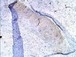 PDE10A Antibody, Novus Biologicals 0.05 mg; Unconjugated:Antibodies, Polyclonal