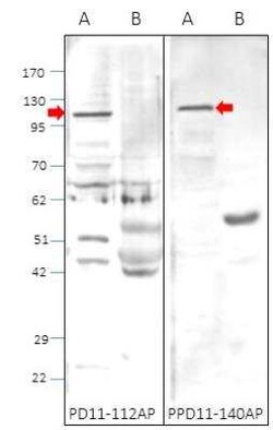 PDE11A Antibody, Novus Biologicals 100 &mu;g | Buy Online | Novus Biologicals | Fisher Scientific