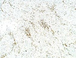 PDE12 Antibody, Novus Biologicals 100 &mu;g | Buy Online | Novus Biologicals | Fisher Scientific