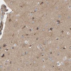 PDE1C Antibody, Novus Biologicals 25 &mu;L, Unconjugated:Antibodies, Polyclonal