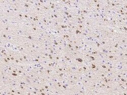 PDE1C Antibody, Novus Biologicals:Antibodies:Primary Antibodies
