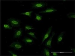 PDE3A Antibody (2D7), Novus Biologicals 0.1 mg | Buy Online | Novus Biologicals | Fisher Scientific