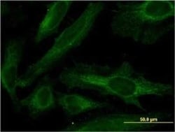 PDE4C Antibody (4E5), Novus Biologicals 0.1 mg | Buy Online | Novus Biologicals | Fisher Scientific