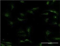 PDE5A Antibody (1F11), Novus Biologicals 0.1 mg | Buy Online | Novus Biologicals | Fisher Scientific
