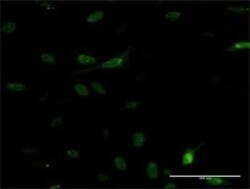 PDE5A Antibody (9H5), Novus Biologicals 0.1 mg | Buy Online | Novus Biologicals | Fisher Scientific