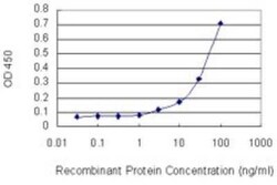 PDE5A Antibody (9H5), Novus Biologicals 0.1 mg | Buy Online | Novus Biologicals | Fisher Scientific
