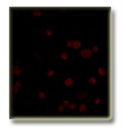 PDE5A Antibody, Novus Biologicals:Antibodies:Primary Antibodies