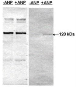 PDE5A Antibody, Novus Biologicals:Antibodies:Primary Antibodies