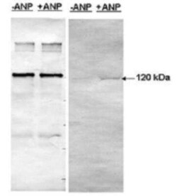 PDE5A Antibody, Novus Biologicals 100 &mu;g | Buy Online | Novus Biologicals | Fisher Scientific