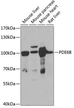 PDE6 beta Antibody - BSA Free, Novus Biologicals:Antibodies:Primary Antibodies
