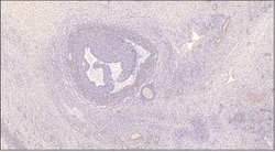 PDE7B Antibody, Novus Biologicals 100 &mu;g | Buy Online | Novus Biologicals | Fisher Scientific