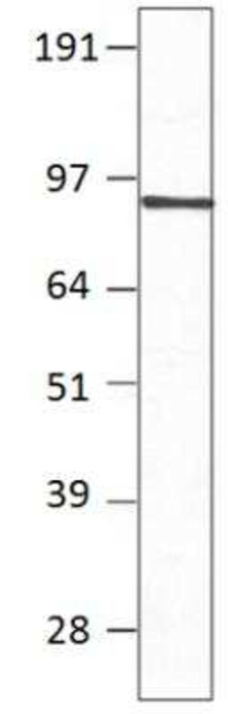 PDE7B Antibody, Novus Biologicals 100 &mu;g | Buy Online | Novus Biologicals | Fisher Scientific