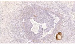 PDE8B Antibody, Novus Biologicals 0.025 mg | Buy Online | Novus Biologicals | Fisher Scientific
