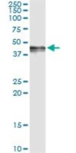 PDGF-D/SCDGFB Antibody (4H2), Novus Biologicals 0.1 mg; Unconjugated:Anticuerpos