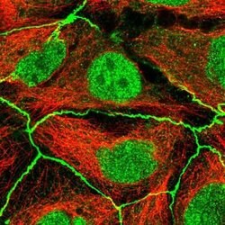 PDGFR alpha Antibody, Novus Biologicals:Antibodies:Primary Antibodies