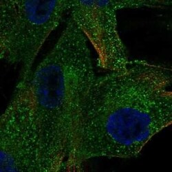 PDGF R beta Antibody, Novus Biologicals 0.1 mL | Buy Online | Novus Biologicals | Fisher Scientific