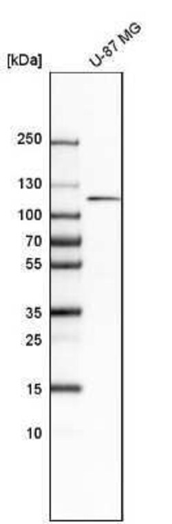 PDGF R beta Antibody, Novus Biologicals 0.1 mL | Buy Online | Novus Biologicals | Fisher Scientific