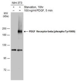 PDGF R beta, p Tyr1009 Antibody, Novus Biologicals 100 &mu;g | Buy Online | Novus Biologicals | Fisher Scientific