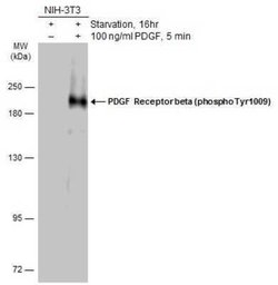 PDGF R beta, p Tyr1009 Antibody, Novus Biologicals 100 &mu;g | Buy Online | Novus Biologicals | Fisher Scientific