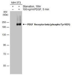 PDGF R beta, p Tyr1021 Antibody, Novus Biologicals 100 &mu;g; Unconjugated:Antibodies,