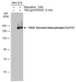PDGF R beta, p Tyr771 Antibody, Novus Biologicals 100 &mu;g | Buy Online | Novus Biologicals | Fisher Scientific
