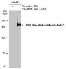 PDGF R beta, p Tyr857 Antibody, Novus Biologicals 100 &mu;g; Unconjugated:Antibodies,