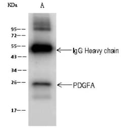 PDGFA Antibody, Novus Biologicals:Antibodies:Primary Antibodies