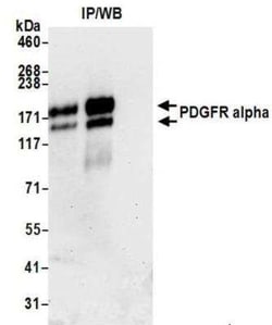 PDGFR alpha Antibody (BLR078G), Novus Biologicals 100 &mu;g | Buy Online | Novus Biologicals | Fisher Scientific