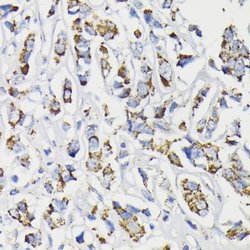 Pyruvate Dehydrogenase E1-alpha subunit Antibody, Novus Biologicals 50&mu;L;