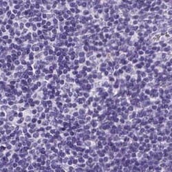 PDIA2 Antibody, Novus Biologicals 0.1 mL, Unconjugated:Antibodies, Polyclonal