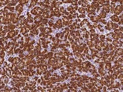 PDIA2 Antibody, Novus Biologicals 50 &mu;g, Unconjugated:Antibodies, Polyclonal