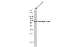 PDIA2 Antibody, Novus Biologicals 100 &mu;g | Buy Online | Bio-Techne | Fisher Scientific