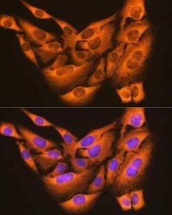 PDIA6 Rabbit anti-Human, Mouse, Rat, Clone: 2Q1L1, Novus Biologicals 100 &mu;g | Buy Online | Novus Biologicals | Fisher Scientific