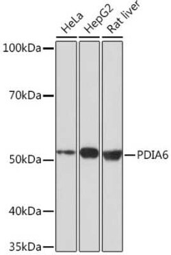 PDIA6 Rabbit anti-Human, Mouse, Rat, Clone: 2Q1L1, Novus Biologicals 100 &mu;g | Buy Online | Novus Biologicals | Fisher Scientific