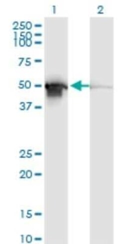 PDIA6 Antibody (3B4), Novus Biologicals 0.1 mg | Buy Online | Novus Biologicals | Fisher Scientific