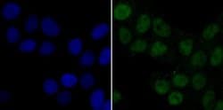Pyruvate Dehydrogenase Kinase 1/PDK1 Antibody (JA67-30), Novus Biologicals