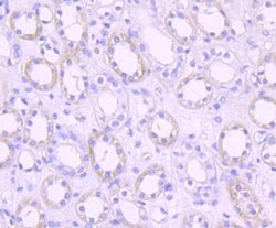 Pyruvate Dehydrogenase Kinase 1/PDK1 Antibody (JA67-30), Novus Biologicals