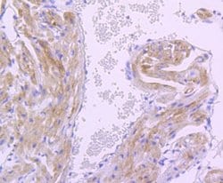 Pyruvate Dehydrogenase Kinase 1/PDK1 Antibody (JA67-30), Novus Biologicals