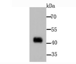 Pyruvate Dehydrogenase Kinase 1/PDK1 Antibody (JA67-30), Novus Biologicals